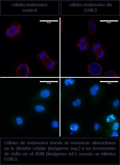 ep las celulasmelanoma adictasla proteina loxl3