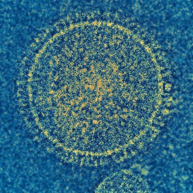 Virus sincitial respiratorio | NIAID ep virus sincitial respiratorio