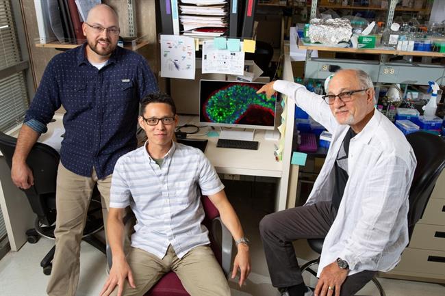 Científicos del Instituto Salk han identificado proteína clave en cáncer mama | SALK INSTITUTE ep cientificosinstituto salkidentificado proteina clavecancer mama