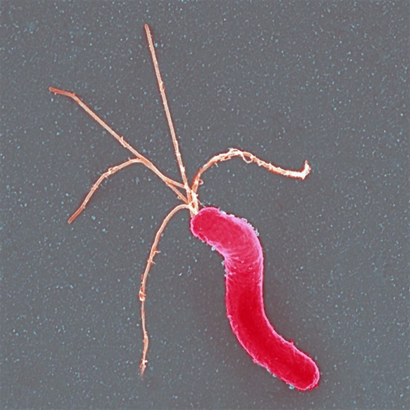 ep helicobacter pylori es una bacteria que infecta el epitelio gastrico humano