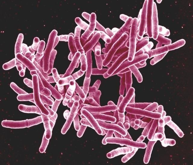 Mycobacterium tuberculosis | FLICKR/NIAID ep mycobacterium tuberculosis