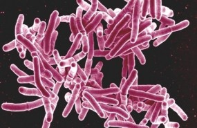 ep mycobacterium tuberculosis
