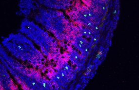 ep a lo largo del borde del intestino delgado las neuronas verdes aparecen muy cerca de la molecula