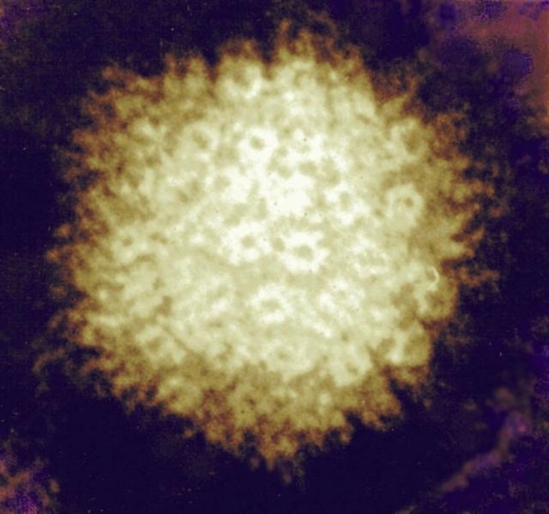 ep herpes zoster