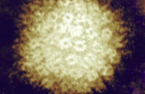 ep herpes zoster