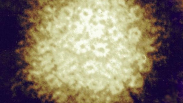 ep herpes zoster