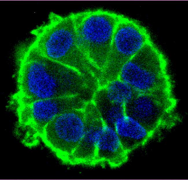 ep crecimiento acinarcelulas tumoralesmodelo 3dmicroambiente tumoral