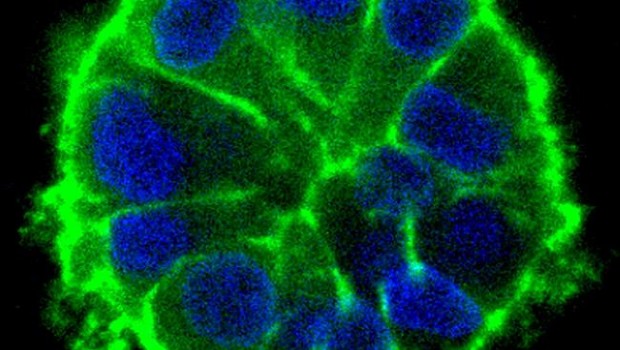 ep crecimiento acinarcelulas tumoralesmodelo 3dmicroambiente tumoral