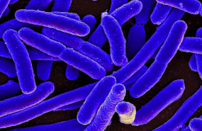 ep micrografia electronica de barrido coloreada de escherichia coli