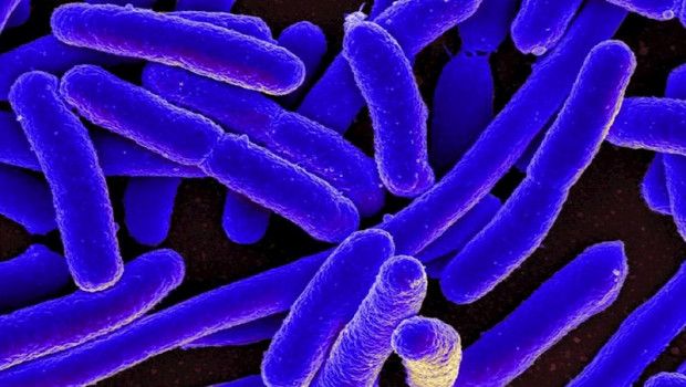 ep micrografia electronica de barrido coloreada de escherichia coli