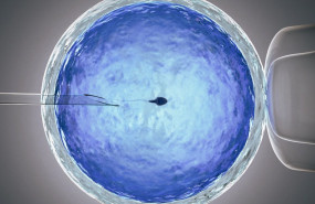 1652784128 fiv 1652784128 fiv