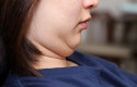 ep experto senalaincrementolas tasasobesidad guardarelacion directalas enfermedades metabolicas ep experto senalaincrementolas tasasobesidad guardarelacion directalas enfermedades metabolicas