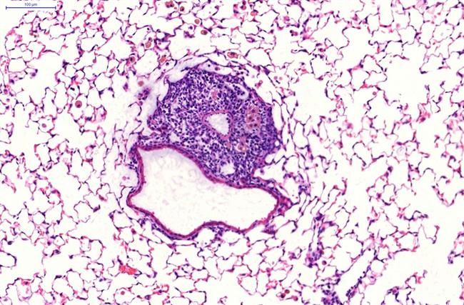 ep imagen microscopicaun ibalt