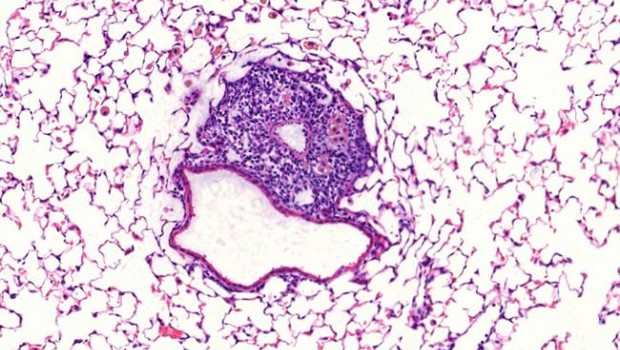 ep imagen microscopicaun ibalt