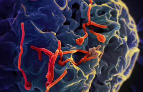 ep imagen microscopicavirus del ebola