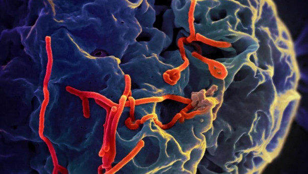 ep imagen microscopicavirus del ebola