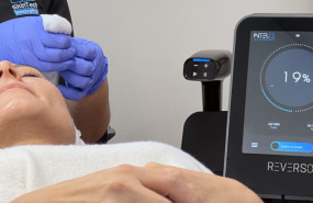 reverso application images img 0189 20240222133331 