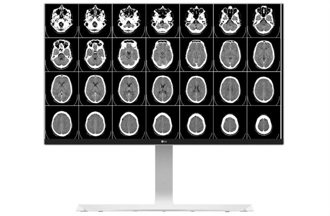 Monitores 4K de LG para profesionales de la Salud | LG ep monitores 4klgprofesionalesla salud