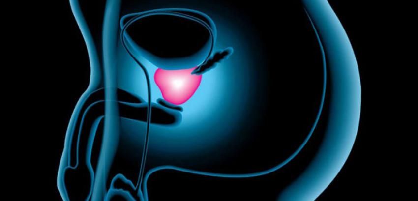 1573477587 largetumores urologicos