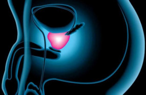 1573477587 largetumores urologicos