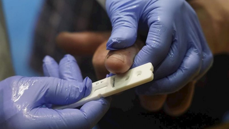 ep un pescador se somete a un test rapido de covid 19 en la costera del bocarte ep un pescador se somete a un test rapido de covid 19 en la costera del bocarte