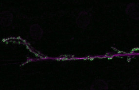 ep union neuromuscular de una neurona y el musculo en verde se muestran las sinapsis