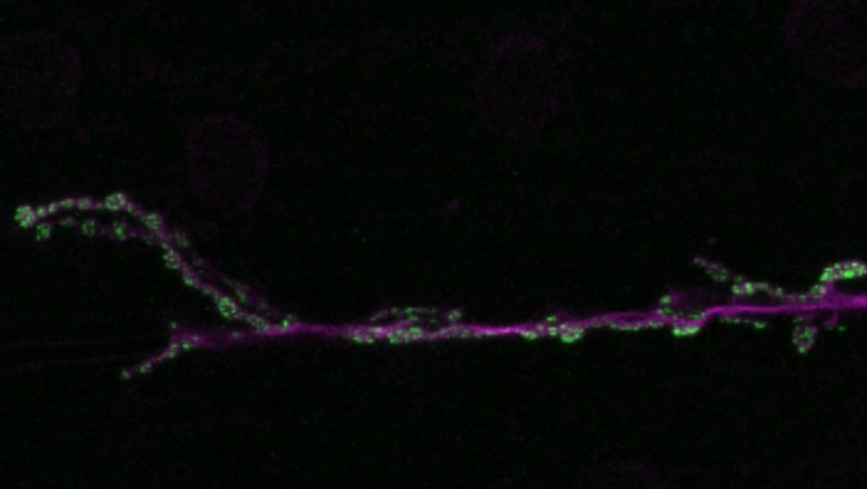 ep union neuromuscular de una neurona y el musculo en verde se muestran las sinapsis ep union neuromuscular de una neurona y el musculo en verde se muestran las sinapsis